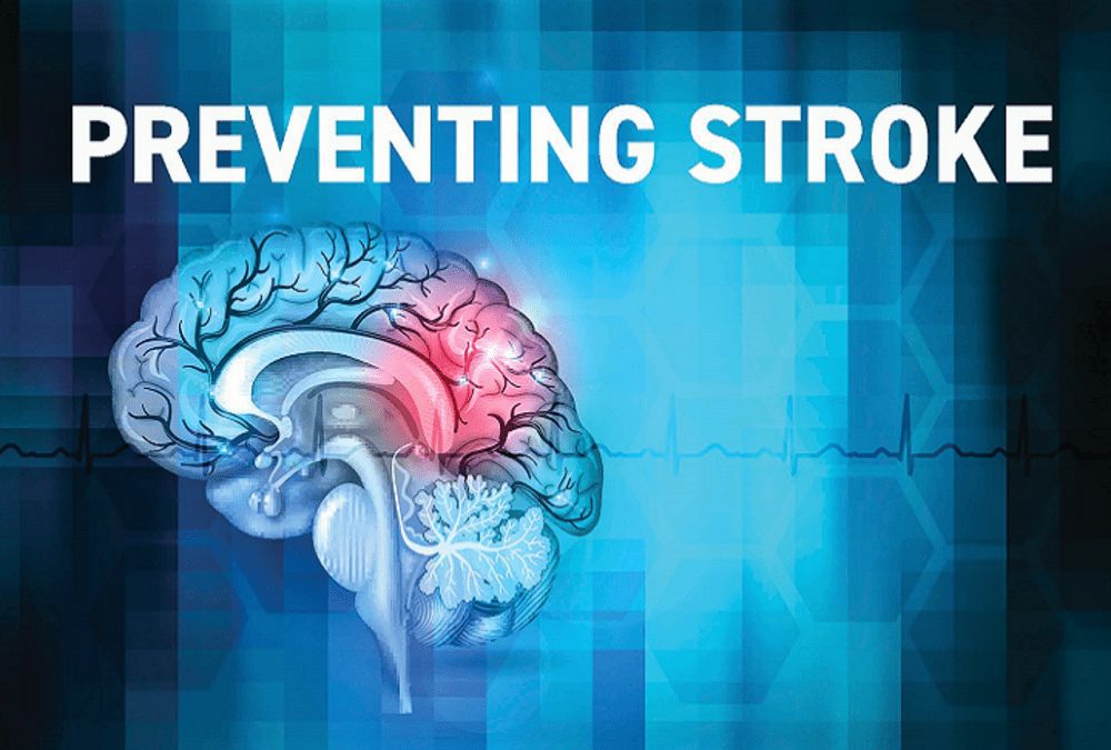 Stroke of Brain