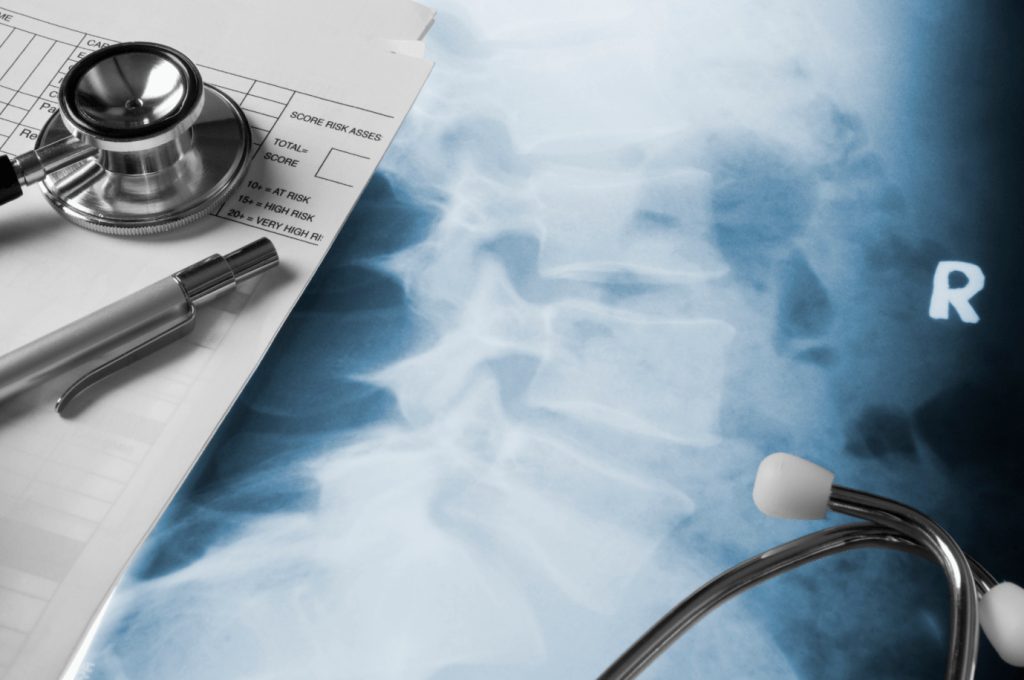 X-Ray