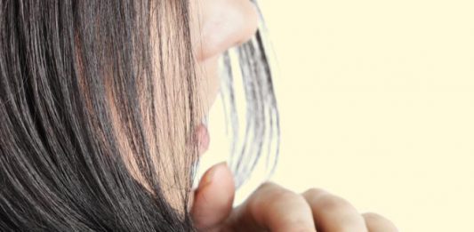 Tips to reduce dandruff