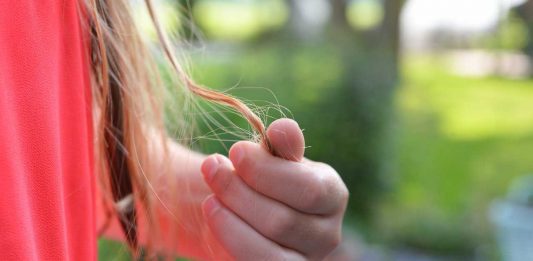 Hair Loss