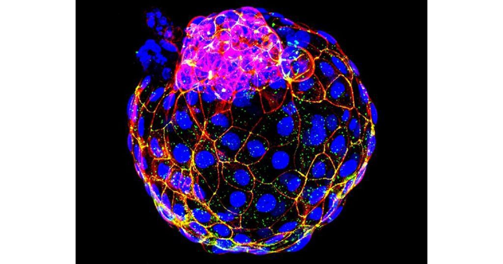 Blastocysts