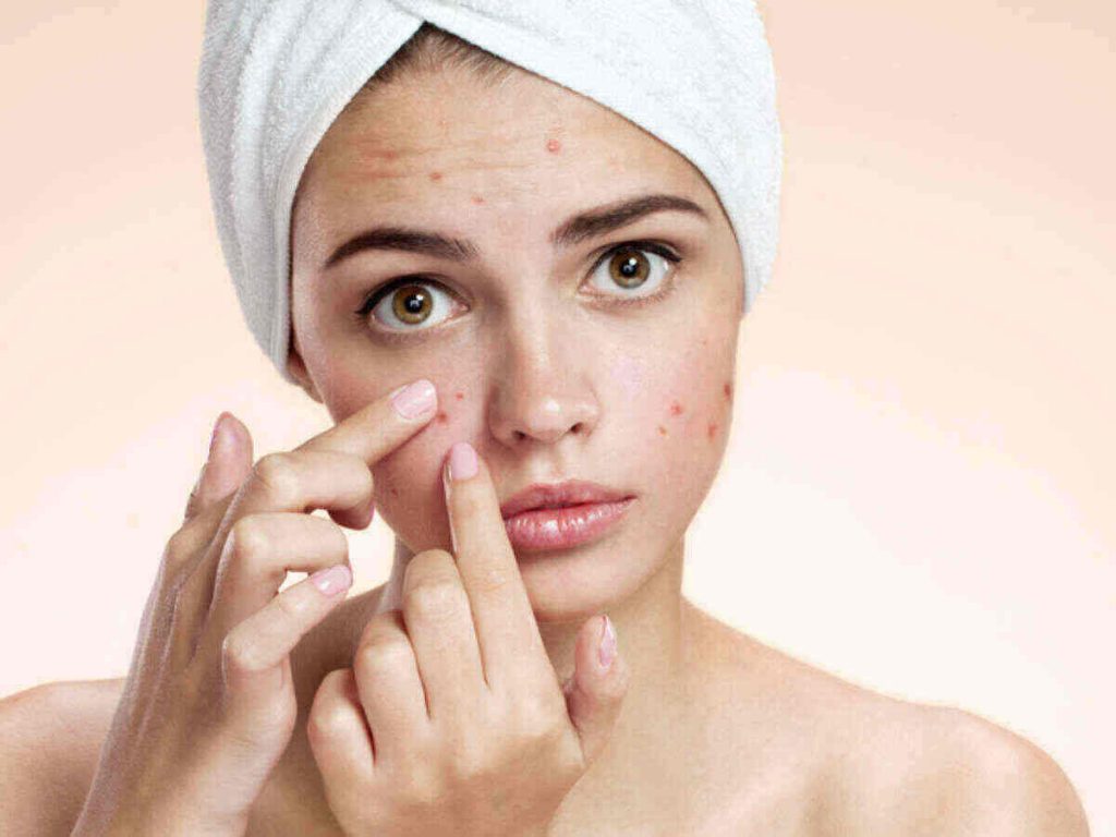 Pimple