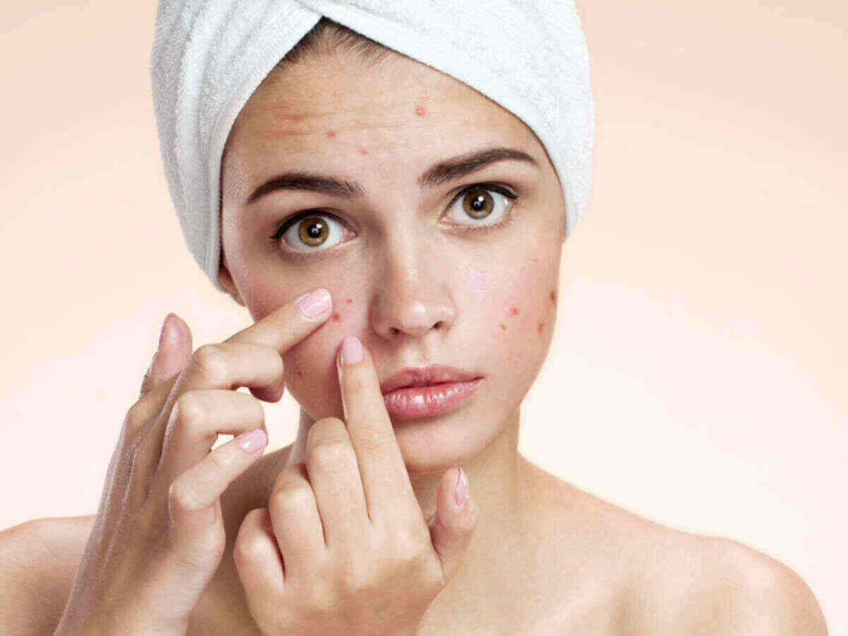 Pimple