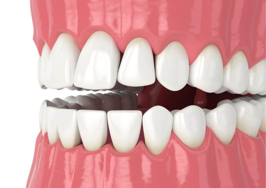 Periodontist