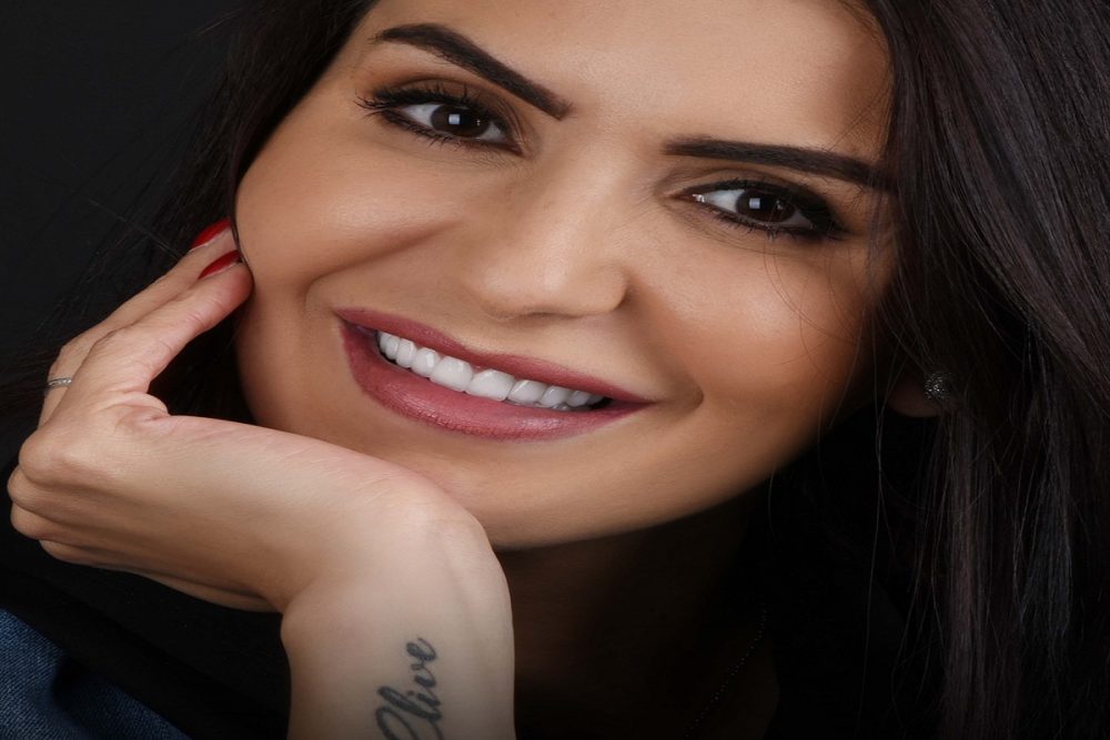 veneers