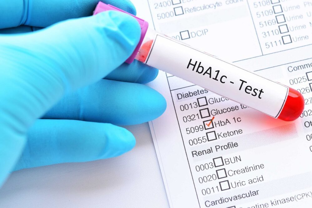 HbA1C chart