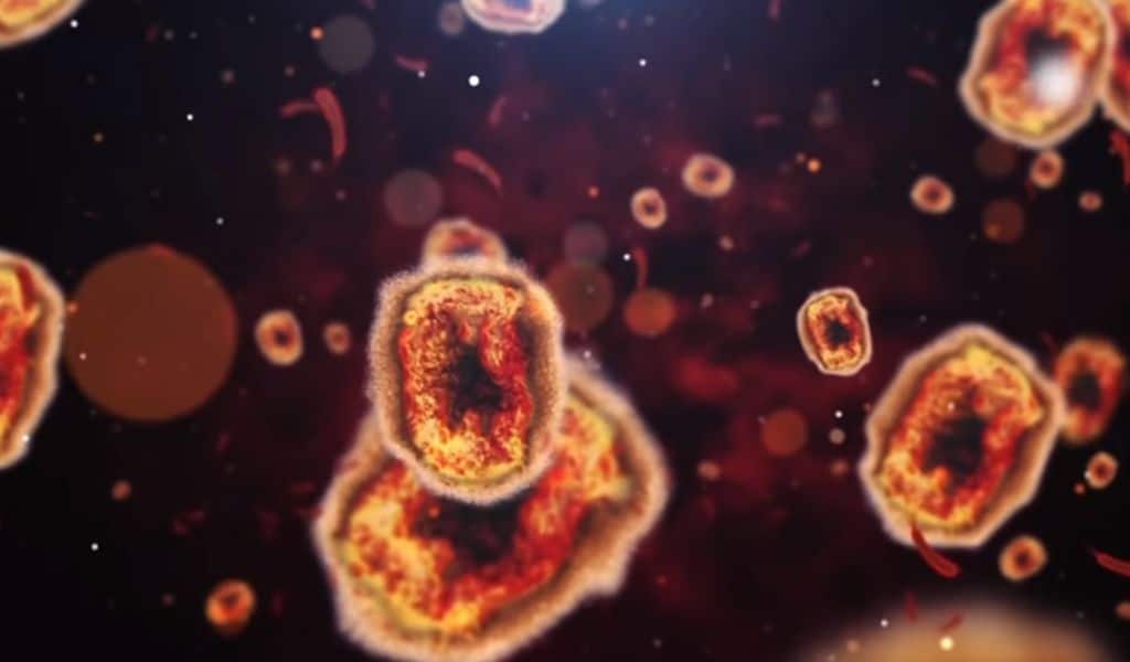 Monkeypox Outbreak