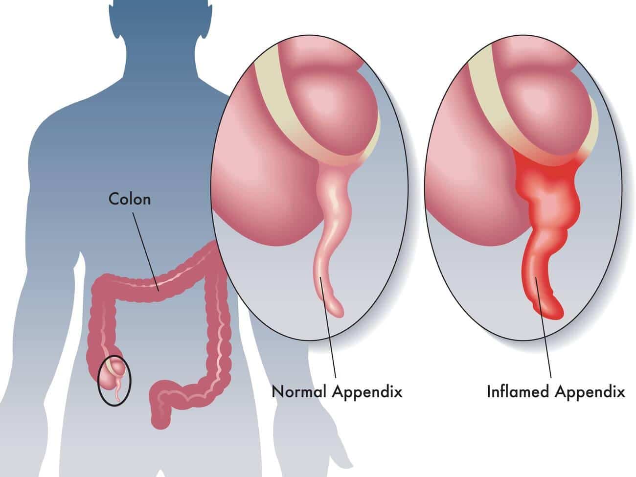 Appendix