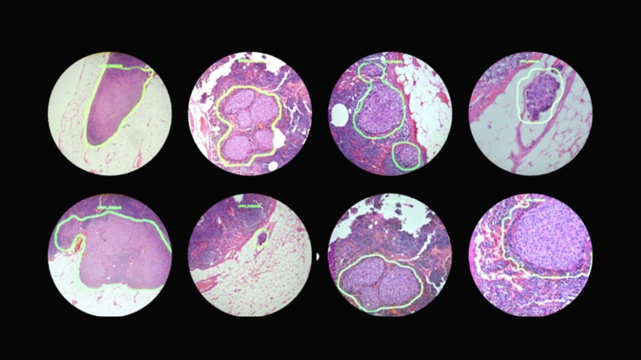 Google is Developing AI-Powered Microscope