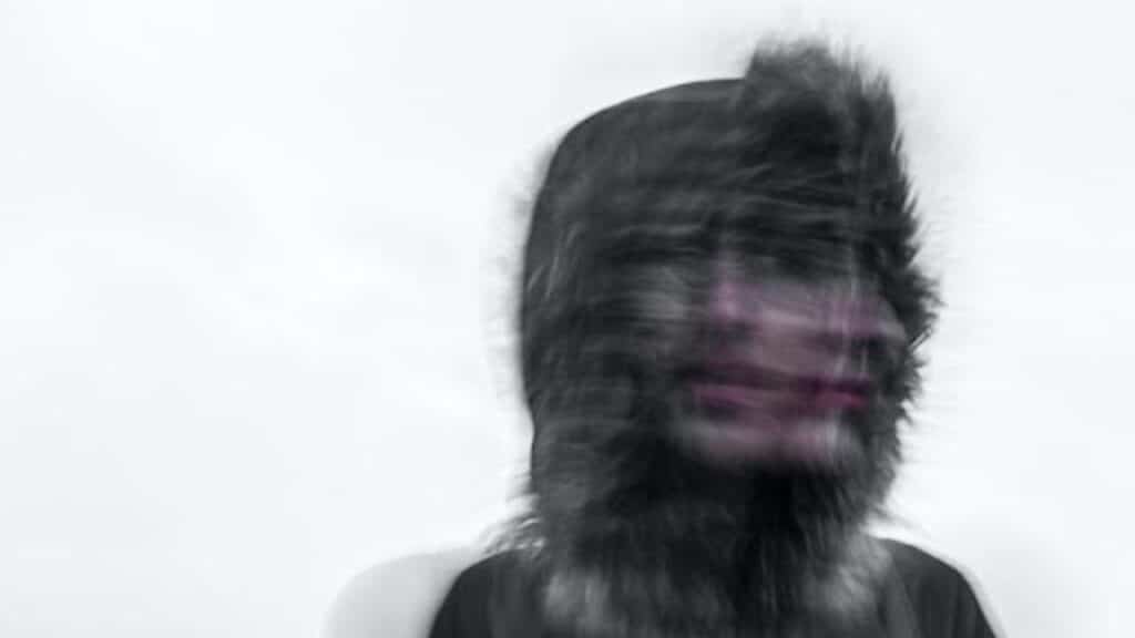 How to Cope With Emotional Trauma After an Accident