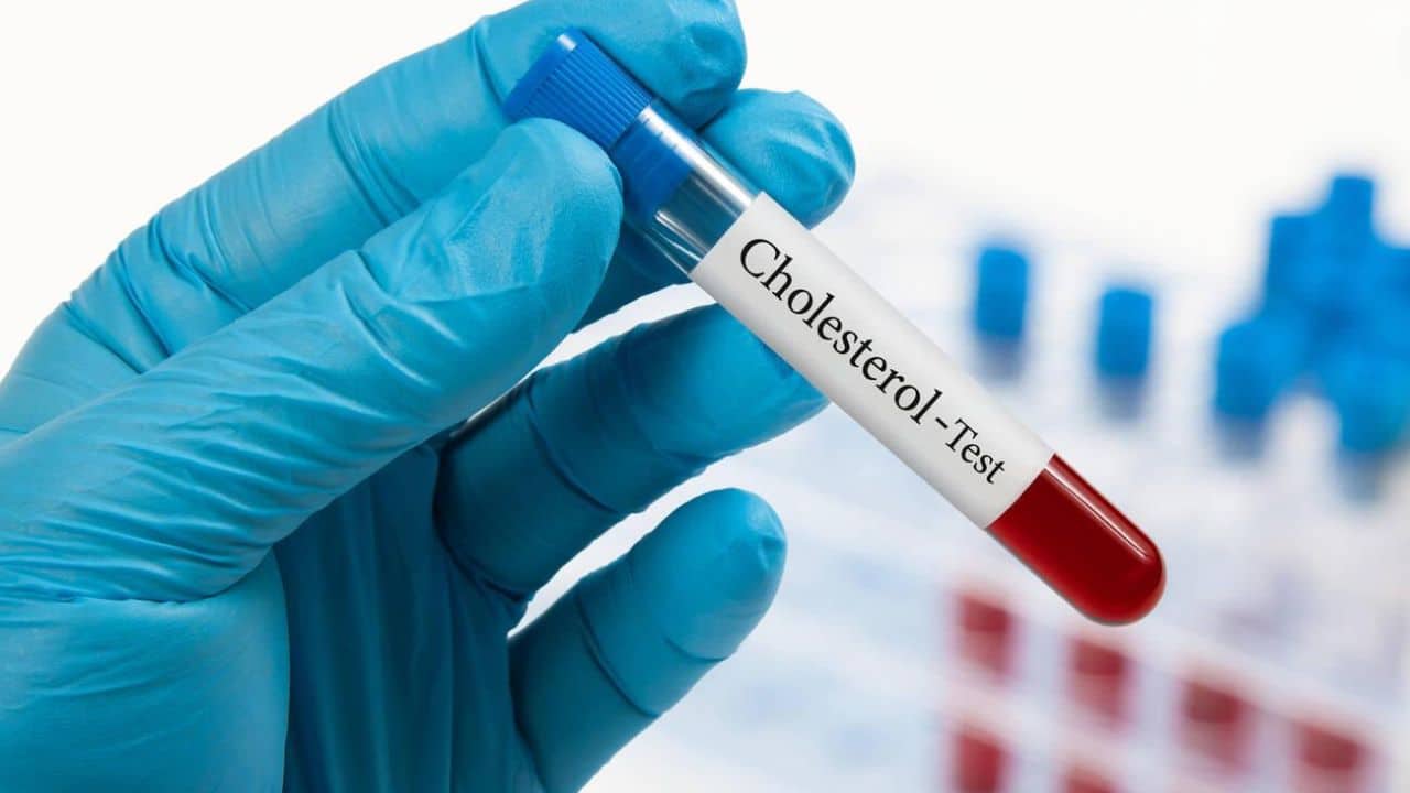 Things to Know About Cholesterol