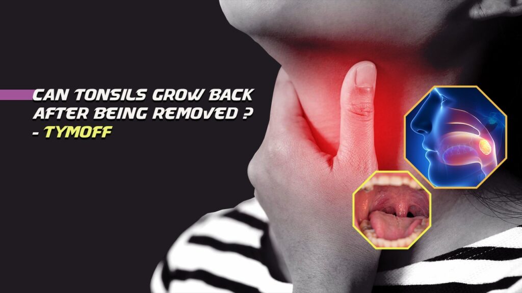 Can Tonsils Grow Back After Being Removed? - Tymoff