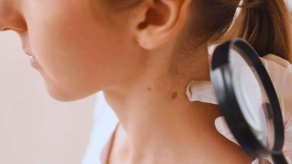 Most Ignored Cancer Symptoms