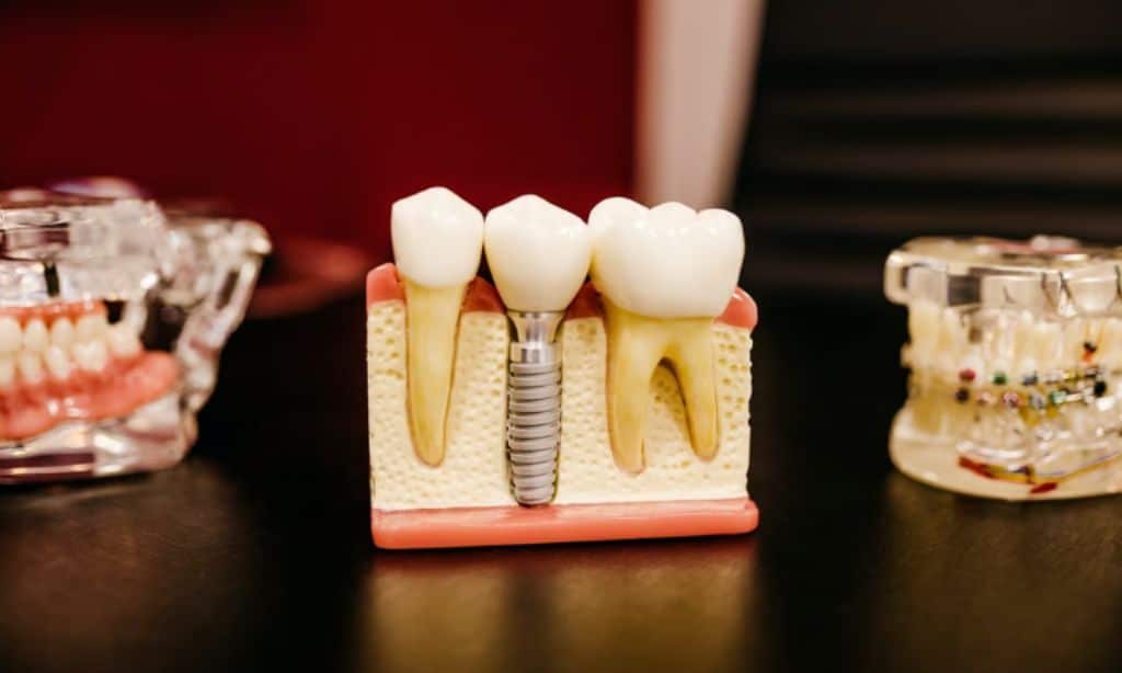 Innovative Educational Opportunities in Bone Healing