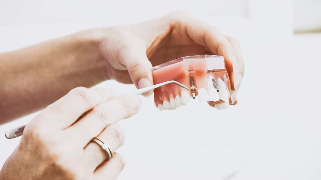 Boost Your Confidence with Dental Implants